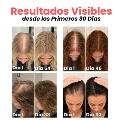 ISYRA™ | Renacer Capilar